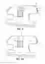 Fig. 05 - Self-ligating bracket with sliding cover