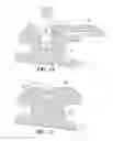 Fig. 07 - Self-ligating bracket with sliding cover
