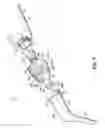 Fig. 12 - Adapters, tips, and dental assemblies