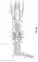 Fig. 14 - Adapters, tips, and dental assemblies