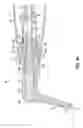 Fig. 16 - Adapters, tips, and dental assemblies