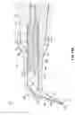 Fig. 24 - Adapters, tips, and dental assemblies