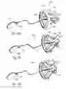 Fig. 08 - ADJUSTABLE TENSION RING FOR AMELIORATION OF URINARY INCONTINENCE IN FEMALES