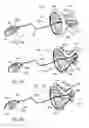 Fig. 09 - ADJUSTABLE TENSION RING FOR AMELIORATION OF URINARY INCONTINENCE IN FEMALES