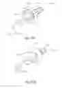 Fig. 10 - ADJUSTABLE TENSION RING FOR AMELIORATION OF URINARY INCONTINENCE IN FEMALES