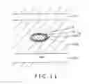 Fig. 11 - MEDICAL DEVICE