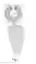 Fig. 02 - Prosthesis for inguinal hernioplasty