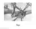 Fig. 03 - Prosthesis for inguinal hernioplasty