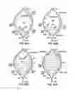 Fig. 28 - ENDOLUMINAL FILTER HAVING ENHANCED ECHOGENIC PROPERTIES