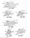 Fig. 35 - ENDOLUMINAL FILTER HAVING ENHANCED ECHOGENIC PROPERTIES