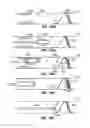 Fig. 46 - ENDOLUMINAL FILTER HAVING ENHANCED ECHOGENIC PROPERTIES