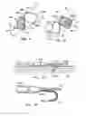 Fig. 63 - ENDOLUMINAL FILTER HAVING ENHANCED ECHOGENIC PROPERTIES