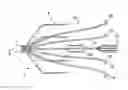 Fig. 01 - Non-entangling vena cava filter