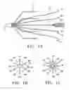 Fig. 02 - Non-entangling vena cava filter