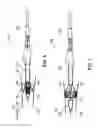 Fig. 05 - Sutureless valve prosthesis delivery device and methods of use thereof