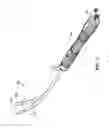Fig. 08 - Sutureless valve prosthesis delivery device and methods of use thereof