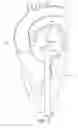 Fig. 09 - Adjustable endolumenal implant for reshaping the mitral valve annulus