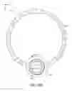 Fig. 14 - Adjustable endolumenal implant for reshaping the mitral valve annulus
