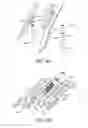 Fig. 15 - Adjustable endolumenal implant for reshaping the mitral valve annulus