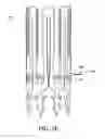 Fig. 16 - Adjustable endolumenal implant for reshaping the mitral valve annulus