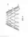 Fig. 25 - Adjustable endolumenal implant for reshaping the mitral valve annulus