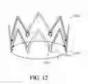 Fig. 29 - Adjustable endolumenal implant for reshaping the mitral valve annulus