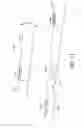 Fig. 31 - Adjustable endolumenal implant for reshaping the mitral valve annulus