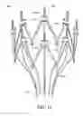 Fig. 37 - Adjustable endolumenal implant for reshaping the mitral valve annulus