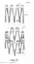 Fig. 52 - Adjustable endolumenal implant for reshaping the mitral valve annulus