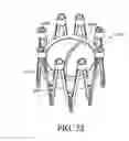 Fig. 53 - Adjustable endolumenal implant for reshaping the mitral valve annulus