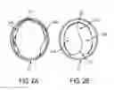Fig. 03 - Expandable implantable conduit