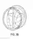 Fig. 05 - Expandable implantable conduit