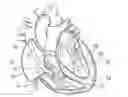 Fig. 01 - Percutaneous valve repair by reshaping and resizing right ventricle