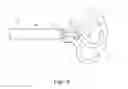 Fig. 04 - Percutaneous valve repair by reshaping and resizing right ventricle