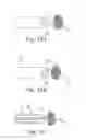 Fig. 18 - Percutaneous valve repair by reshaping and resizing right ventricle