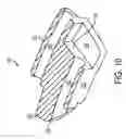 Fig. 09 - Dynamic annuloplasty ring sizer