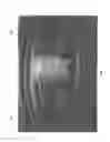 Fig. 05 - Automated implantable penile prosthesis pump system
