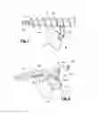 Fig. 02 - Device for repairing an intervertebral disc