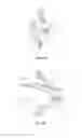 Fig. 04 - Spinal implant configured for lateral insertion