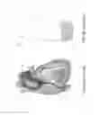 Fig. 03 - Methods and apparatuses for treating vessels
