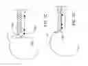 Fig. 10 - Methods and apparatuses for treating vessels