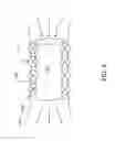 Fig. 11 - Methods and apparatuses for treating vessels