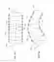 Fig. 13 - Methods and apparatuses for treating vessels