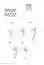 Fig. 05 - Branched stent graft, delivery system comprising same and method of fabricating same