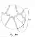 Fig. 11 - Stent having adjacent elements connected by narrow flexible webs