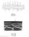 Fig. 16 - Stent having adjacent elements connected by narrow flexible webs