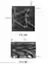 Fig. 18 - Stent having adjacent elements connected by narrow flexible webs