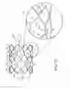 Fig. 30 - Stent having adjacent elements connected by narrow flexible webs