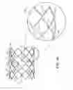 Fig. 33 - Stent having adjacent elements connected by narrow flexible webs