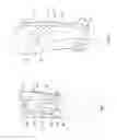 Fig. 02 - Orthopedic device for treating complications of the hip